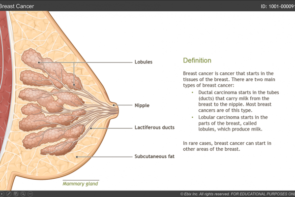 Breast Cancer eLearning