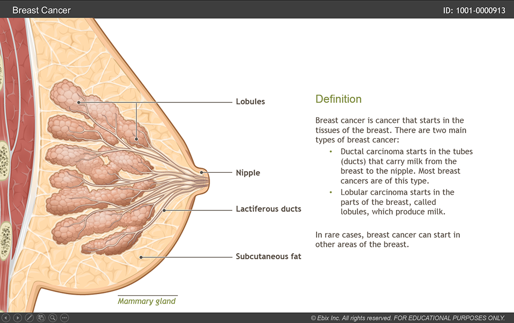 Breast Cancer eLearning