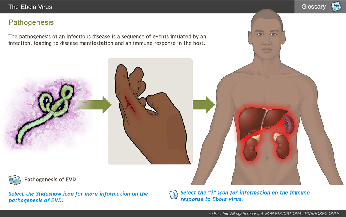Understanding Ebola eLearning